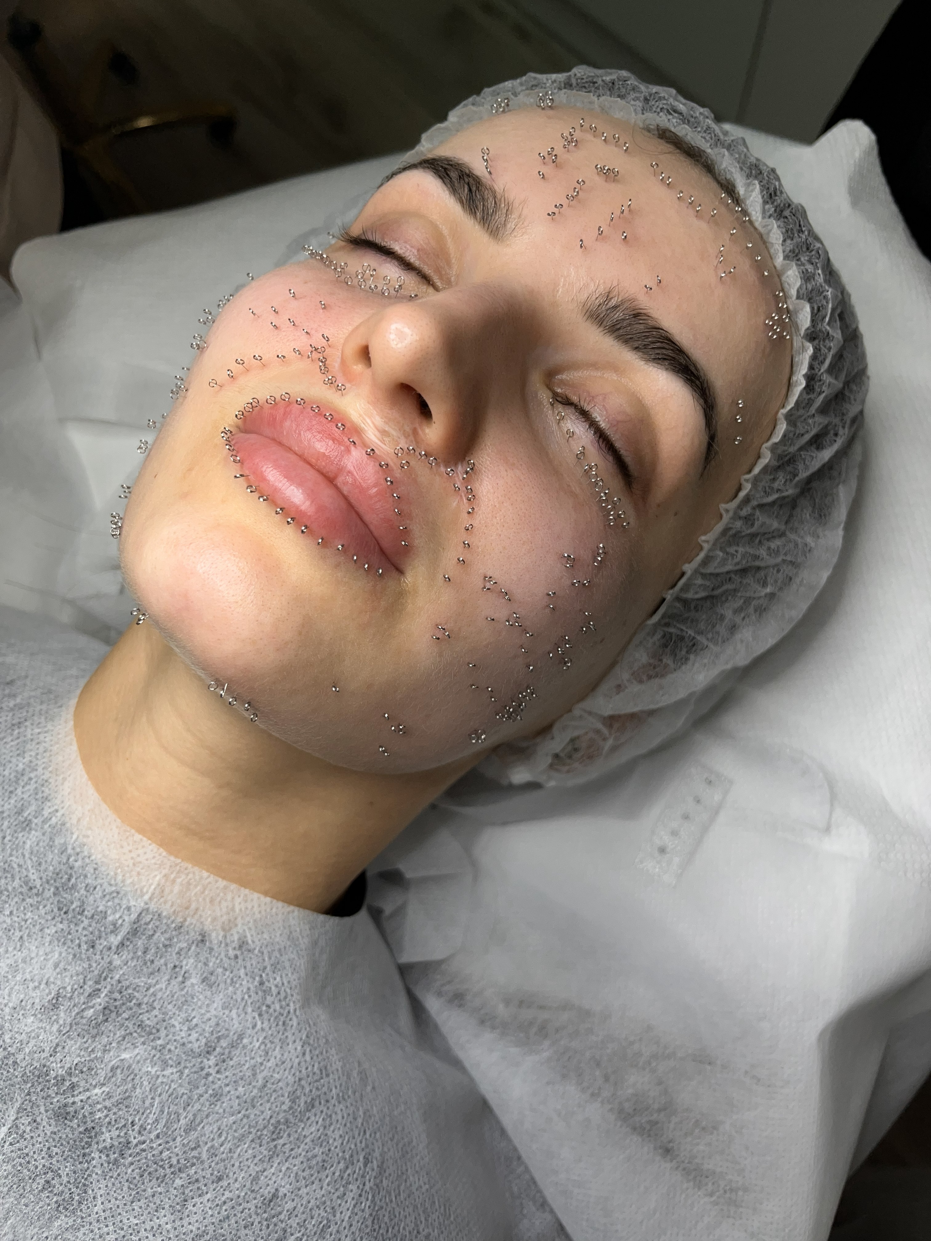 Pinezkowanie efekt 2